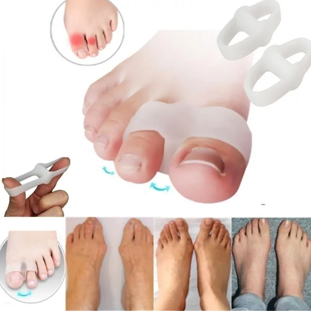 2 Holes Bunion Corrector Pain  – Correction Fluid White Bewertung und Preis
